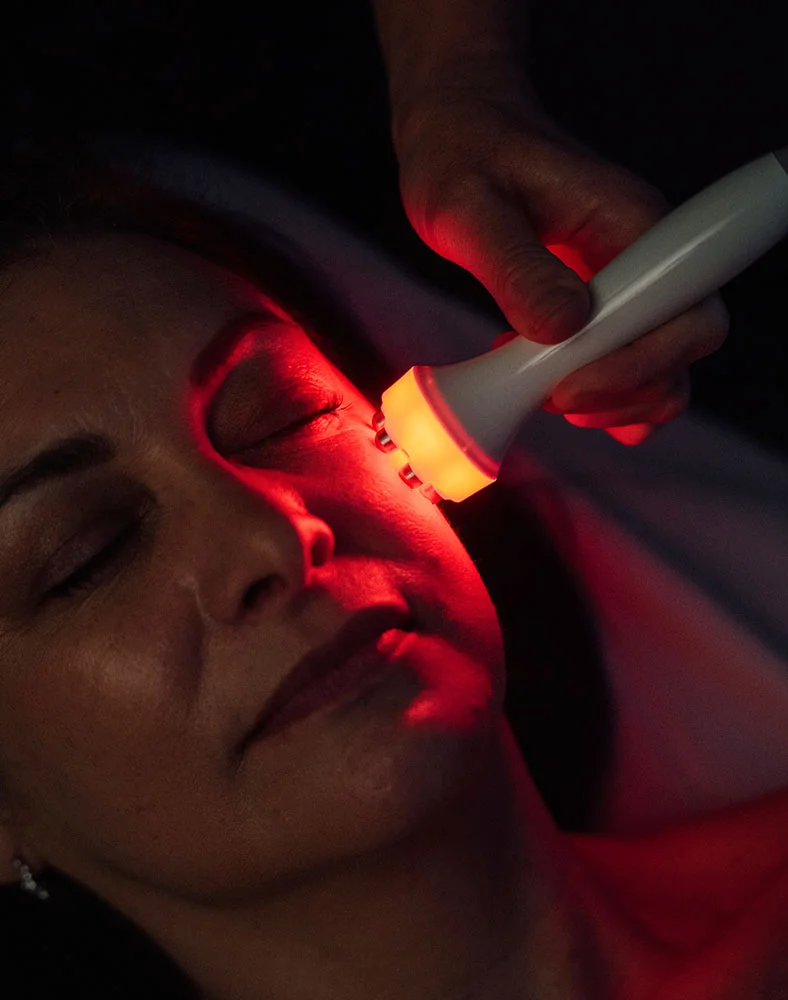 ipl-photofacial-intro