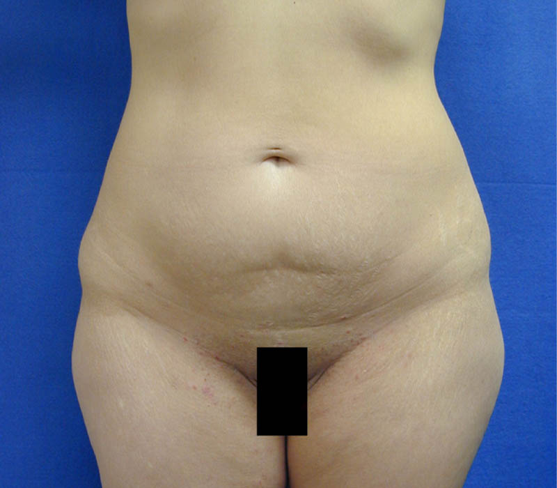 1_0030_meibefore (2).jpg