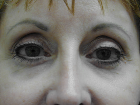 1_0047_RCa-1.JPG.jpg