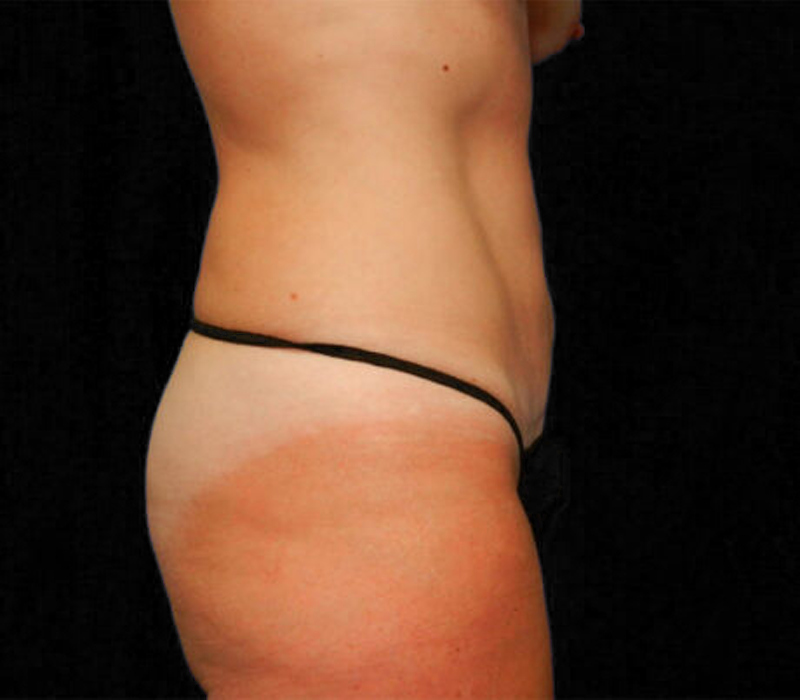 1_0047_TTafter-3.JPG-460×403.jpg