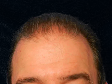 imgi_5_1_0001_GRa-1.JPG.webp