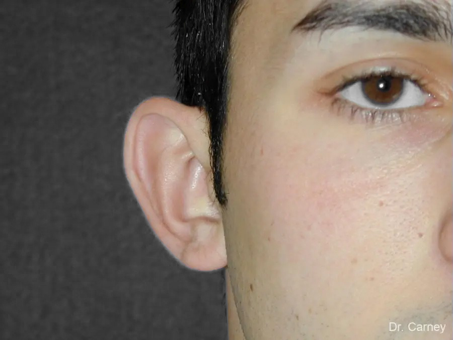 imgi_4_ear1.jpg