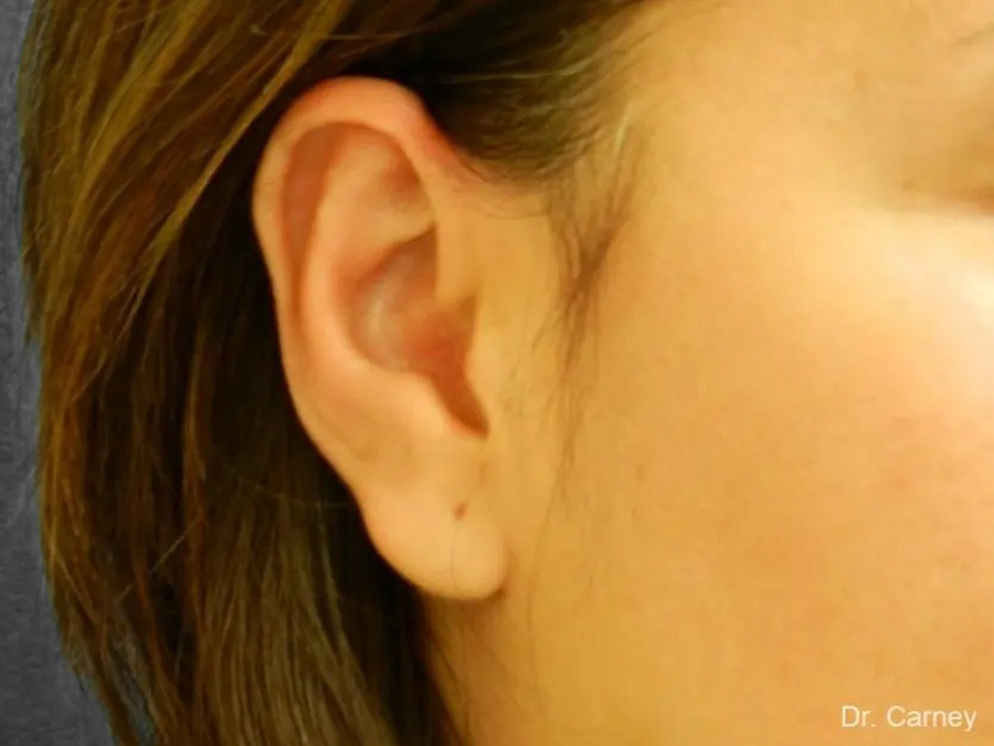 imgi_7_ear4.jpg