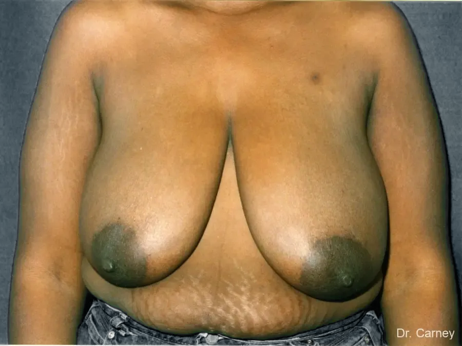 imgi_8_bl5.webp