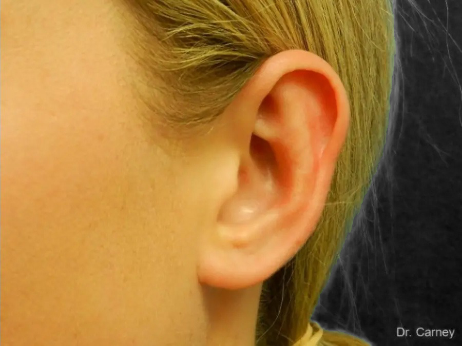 imgi_9_ear6.jpg
